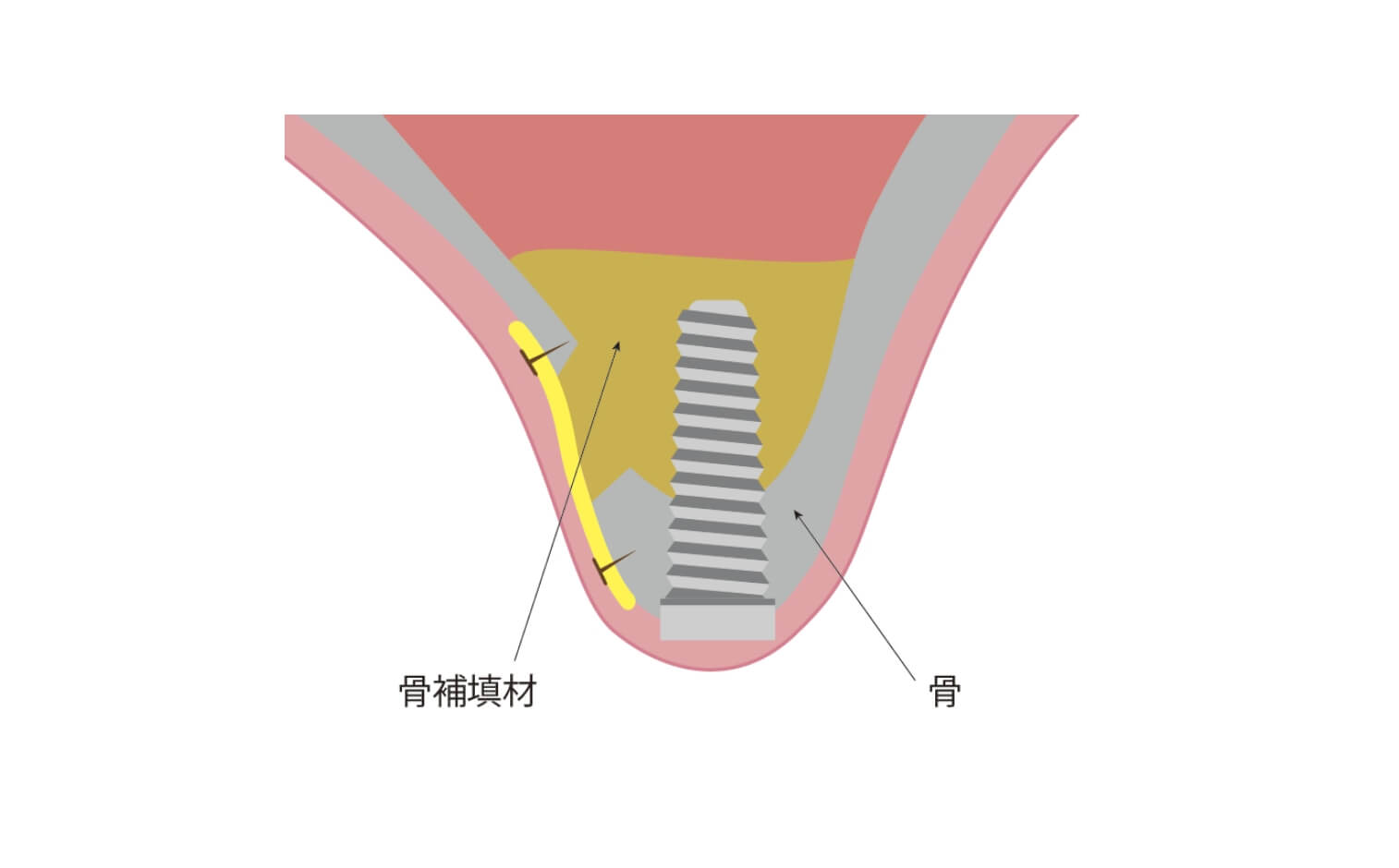 丁寧なカウンセリング