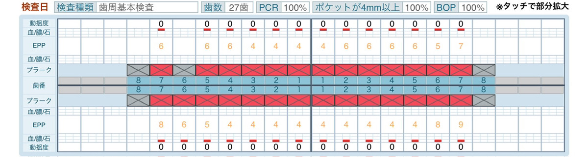 検査表